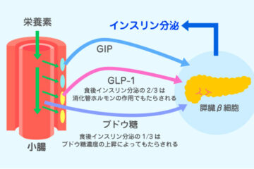 糖尿病は歯周病に悪影響を与える